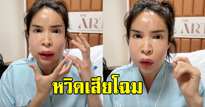 ช็อก นัท นิสามณี ผ่าตัดด่วน พบก้อนขนาดใหญ่ผิดปกติบนหน้า