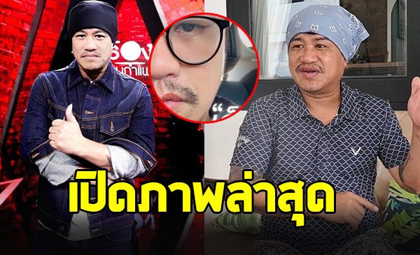เปิดภาพล่าสุด อู๊ด เป็นต่อ หลังศัลยกรรมในวัย 50 ปี