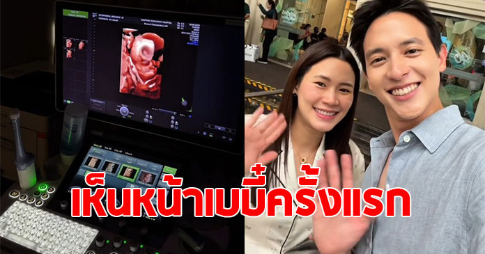 เจมส์ จิรายุ เปิดภาพอัลตร้าซาวด์ เห็นหน้าลูกครั้งแรก