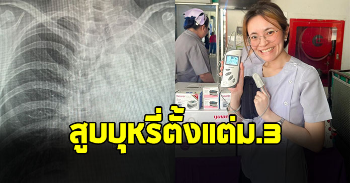 หมอเตือนแรง เปิดเคสอุทาหรณ์ สูบบุหรี่ตั้งแต่ ม.3 สุดท้ายเจอเต็มๆตอนอายุ 30